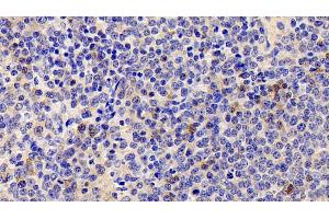 Detection of IL22R in Human Spleen Tissue using Polyclonal Antibody to Interleukin 22 Receptor (IL22R) (IL22R 抗体  (AA 267-565))