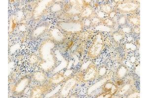 anti-Angio-Associated, Migratory Cell Protein (AAMP) (Internal Region) antibody