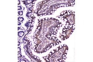 IHC analysis of TANK using anti-TANK antibody (ABIN6719508). (TANK 抗体)