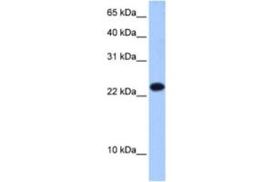 Western Blotting (WB) image for anti-Eukaryotic Translation Initiation Factor 4E Family Member 3 (EIF4E3) antibody (ABIN2462352) (EIF4E3 抗体)
