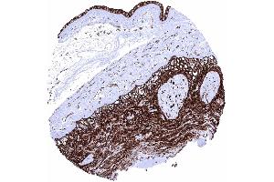 Immunohistochemistry (IHC) image for anti-Solute Carrier Family 2 (Facilitated Glucose Transporter), Member 1 (SLC2A1) (AA 203-305) antibody (ABIN7477481)