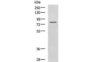 Western blot analysis of Rat liver tissue lysate using DHX58 Polyclonal Antibody at dilution of 1:800 (DHX58 抗体)