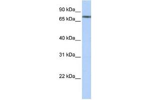 WB Suggested Anti-TRIM29 Antibody Titration:  0. (TRIM29 抗体  (N-Term))