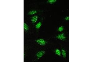 IF analysis of PAX5 using anti-PAX5 antibody (ABIN5692907).