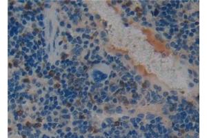 Detection of PAI1 in Mouse Spleen Tissue using Polyclonal Antibody to Plasminogen Activator Inhibitor 1 (PAI1) (PAI1 抗体  (AA 141-389))