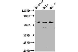Western Blot Positive WB detected in: SH-SY5Y whole cell lysate, Hela whole cell lysate, MCF-7 whole cell lysate All lanes: RANBP10 antibody at 2. (RANBP1 抗体  (AA 3-165))