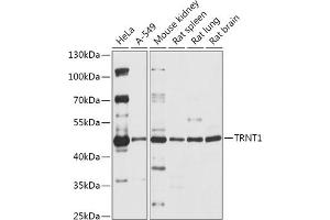 Western blot analysis of extracts of various cell lines, using TRNT1 antibody (ABIN7271005) at 1:1000 dilution. (Trnt1 抗体  (AA 135-434))