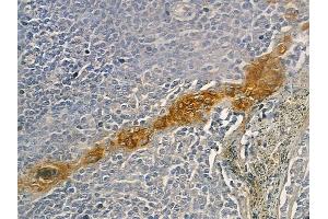 ABIN6260193 and ABIN6272675 at 1/100 staining human normal lung tissue by IHC-P.