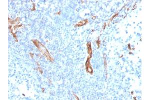 Formalin-fixed, paraffin-embedded human prostate stained with CD31 Mouse Monoclonal Antibody (PECAM1/3527).