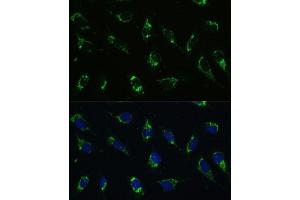 Immunofluorescence analysis of U-2 OS cells using I antibody (ABIN7265720) at dilution of 1:100.