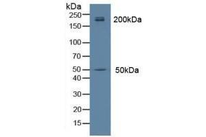 Detection of MYH14 in Rat Brain Tissue using Polyclonal Antibody to Myosin Heavy Chain 14, Non Muscle (MYH14) (Myosin 抗体  (AA 1069-1331))