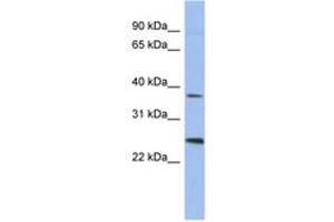 Image no. 1 for anti-Melanoma Antigen Family B, 2 (MAGEB2) (AA 71-120) antibody (ABIN6744051) (MAGEB2 抗体  (AA 71-120))