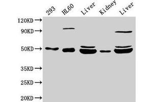 Western Blot Positive WB detected in: 293 whole cell lysate, HL60 whole cell lysate, Rat liver tissue, Mouse kidney tissue, Mouse liver tissue All lanes: NADK2 antibody at 4 μg/mL Secondary Goat polyclonal to rabbit IgG at 1/50000 dilution Predicted band size: 50, 46, 32 kDa Observed band size: 50, 46 kDa (NADK2 抗体  (AA 16-156))