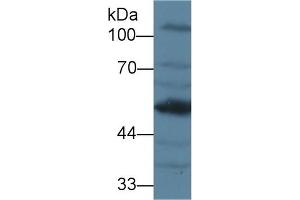 Detection of AGT in Mouse Kidney lysate using Polyclonal Antibody to Angiotensinogen (AGT) (AGT 抗体  (AA 23-477))