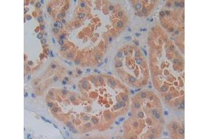 Used in DAB staining on fromalin fixed paraffin- embedded kidney tissue (LYPLA2 抗体  (AA 1-196))