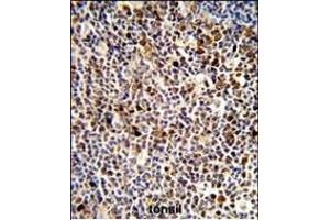 Immunohistochemistry (Paraffin-embedded Sections) (IHC (p)) image for anti-Killer Cell Immunoglobulin-Like Receptor, three Domains, Long Cytoplasmic Tail, 3 (KIR3DL3) (AA 132-158) antibody (ABIN653117)