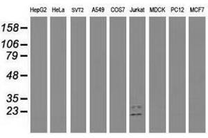 Image no. 1 for anti-Guanylate Kinase 1 (GUK1) antibody (ABIN1498566) (GUK1 抗体)
