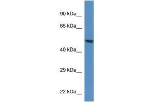 WB Suggested Anti-Trim11 Antibody   Titration: 1. (TRIM11 抗体  (C-Term))