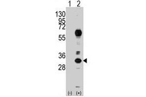 Western blot analysis of CD8A (arrow) using rabbit CD8A polyclonal antibody . (CD8 alpha 抗体  (N-Term))