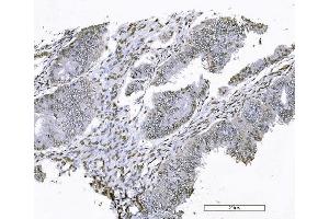 IHC analysis of FOXK1 using anti-FOXK1 antibody (ABIN7600295).