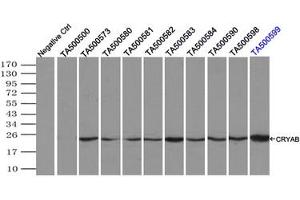 Image no. 8 for anti-Crystallin, alpha B (CRYAB) antibody (ABIN1497647)