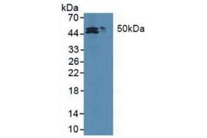 Western blot analysis of (1) Human HepG2 cells and (2) Human HCT116 cell. (MAT2A 抗体  (AA 176-395))