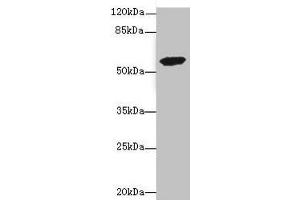 Western blot All lanes: ETFDH antibody at 3. (ETFDH 抗体  (AA 318-617))