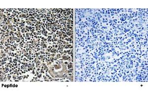 Immunohistochemistry analysis of paraffin-embedded human thymus gland tissue using CBLN4 polyclonal antibody . (CBLN4 抗体)