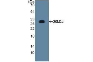 Detection of Recombinant ADAM10, Human using Polyclonal Antibody to A Disintegrin And Metalloprotease 10 (ADAM10) (ADAM10 抗体  (AA 420-641))