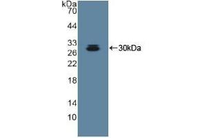 Detection of Recombinant ADAM10, Human using Polyclonal Antibody to A Disintegrin And Metalloprotease 10 (ADAM10)