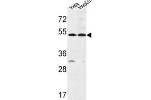 Western Blotting (WB) image for anti-Fermitin Family Member 1 (FERMT1) antibody (ABIN3003961) (FERMT1 抗体)