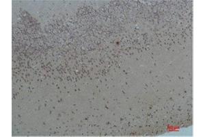 Immunohistochemistry (IHC) analysis of paraffin-embedded Rat Brain Tissue using Bombesin Receptor 2 Rabbit Polyclonal Antibody diluted at 1:200. (Bombesin Receptor 2 抗体)