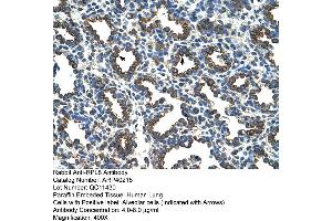 Rabbit Anti-RPL8 Antibody  Paraffin Embedded Tissue: Human Lung Cellular Data: Alveolar cells Antibody Concentration: 4. (RPL8 抗体  (C-Term))