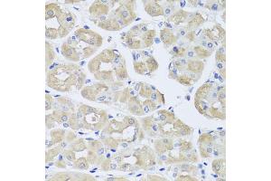 Immunohistochemistry of paraffin-embedded human stomach using BGLAP antibody (ABIN5975009) at dilution of 1/100 (40x lens). (Osteocalcin 抗体)