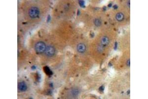 Used in DAB staining on fromalin fixed paraffin-embedded Liver tissue (IGF2 抗体  (AA 25-91))