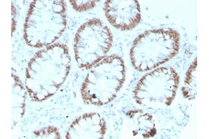 Immunohistochemistry (IHC) image for anti-Caudal Type Homeobox 2 (CDX2) (AA 150-249) antibody (ABIN6939059)