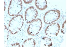 Formalin-fixed, paraffin-embedded human Colon stained with CDX2 Mouse Monoclonal Antibody (rCDX2/1690).