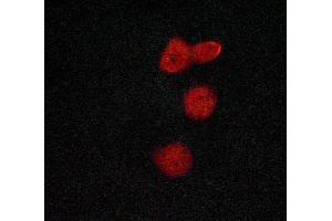ABIN6269067 staining Hela cells by ICC/IF. (MSK1 抗体  (Internal Region))