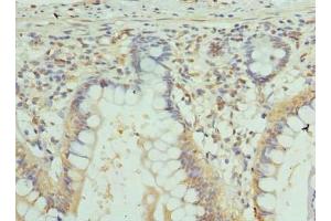 Immunohistochemistry of paraffin-embedded human small intestine tissue using ABIN7153593 at dilution of 1:100 (GJA4 抗体  (AA 231-333))