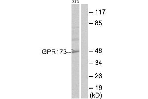 Western blot analysis of extracts from NIH-3T3 cells, using GPR173 antibody. (GPR173 抗体  (Internal Region))