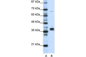 WB Suggested Anti-HNRPDL Antibody Titration:  1. (HNRPDL 抗体  (Middle Region))
