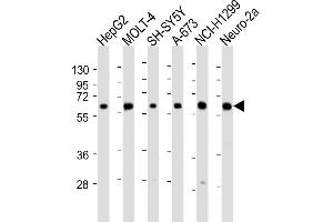 All lanes : Anti-CHRNA4 Antibody (N-Term) at 1:2000 dilution Lane 1: HepG2 whole cell lysate Lane 2: MOLT-4 whole cell lysate Lane 3: SH-SY5Y whole cell lysate Lane 4: A-673 whole cell lysate Lane 5: NCI- whole cell lysate Lane 6: Neuro-2a whole cell lysate Lysates/proteins at 20 μg per lane. (CHRNA4 抗体  (AA 176-208))