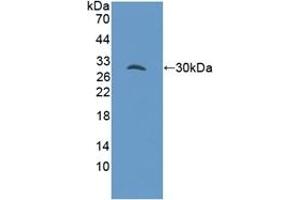 Detection of Recombinant GAB3, Mouse using Polyclonal Antibody to GRB2 Associated Binding Protein 3 (GAB3) (GAB3 抗体  (AA 142-375))
