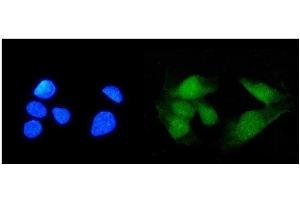 IF analysis of TRIM21/SS-A using anti-TRIM21/SS-A antibody (ABIN7599820).