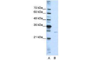 WB Suggested Anti-EMG1  Antibody Titration: 0.
