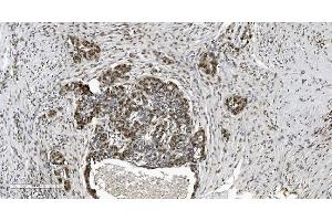 IHC analysis of HP1 alpha/CBX5 using anti-HP1 alpha/CBX5 antibody (ABIN7599057).