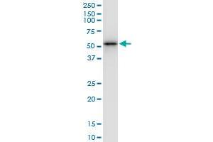 Immunoprecipitation of YBX2 transfected lysate using anti-YBX2 MaxPab rabbit polyclonal antibody and Protein A Magnetic Bead , and immunoblotted with YBX2 MaxPab mouse polyclonal antibody (B01) . (YBX2 抗体  (AA 1-364))