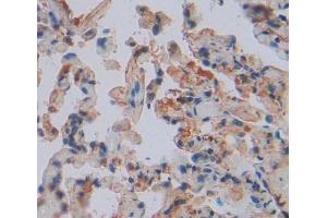 IHC-P analysis of lung tissue, with DAB staining. (LARS 抗体  (AA 260-509))