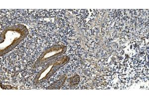 IHC analysis of NOX2/gp91phox/CYBB using anti-NOX2/gp91phox/CYBB antibody (ABIN7599875). (CYBB 抗体  (AA 124-559))