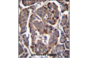 RAB11B Antibody (C-term) (ABIN1881719 and ABIN2846071) immunohistochemistry analysis in formalin fixed and paraffin embedded human pancreas tissue followed by peroxidase conjugation of the secondary antibody and DAB staining. (RAB11B 抗体  (C-Term))